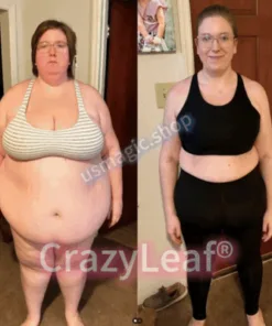 CrazyLeaf® Tirzepatide GIP/GLP-1 Dual-Action Slimming & Health Boost Drops