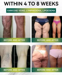 𝐂𝐫𝐚𝐳𝐲𝐋𝐞𝐚𝐟® 𝐆𝐋𝐏-𝟏 𝐖𝐞𝐢𝐠𝐡𝐭 𝐋𝐨𝐬𝐬 𝐃𝐫𝐨𝐩𝐬,𝐒𝐮𝐩𝐩𝐨𝐫𝐭𝐬
