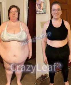 CrazyLeaf® Tirzepatide GIP/GLP-1 Dual-Action Slimming & Health Boost Drops