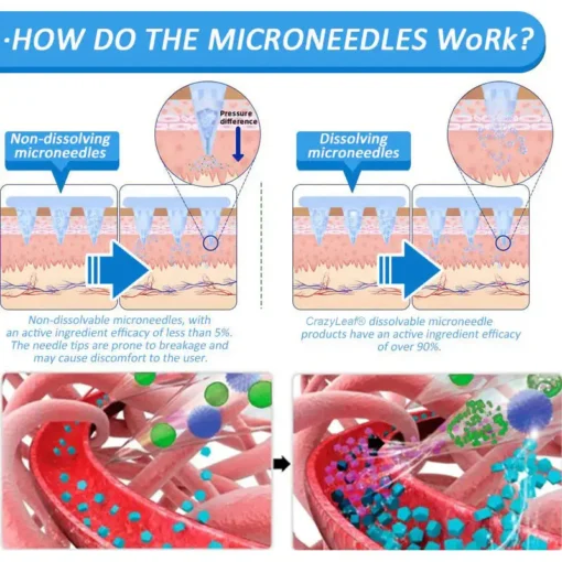 CrazyLeaf® Nano Microneedle Patch with SMGT-GLP-1